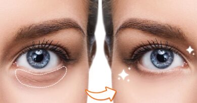 Schnelle Tipps: So beseitigen Sie dunkle Ringe unter Ihren Augen