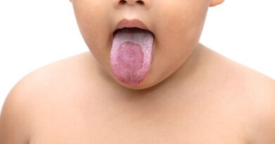 8 häufige Ursachen einer Pilzinfektion bei Kindern