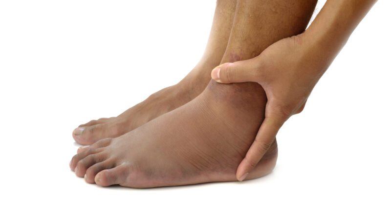 8 Symptome einer schlechten Durchblutung, die Sie nicht ignorieren können